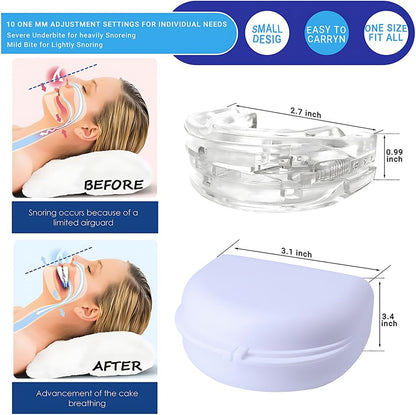 Anti Snoring Devices - Effective Snoring Aids for Men & Women, Versatile & Comfortable Mouth Guard for Home and Travel Sleep Solutions (Light White)
